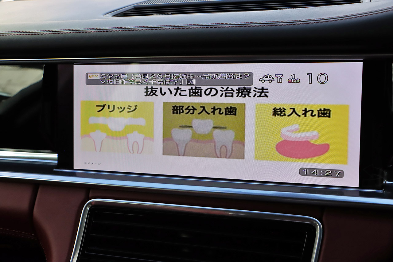 車両画像