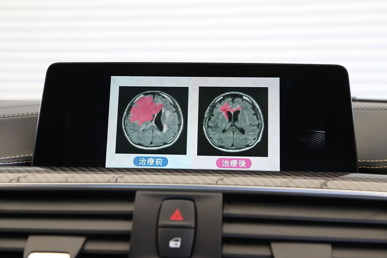 車両画像